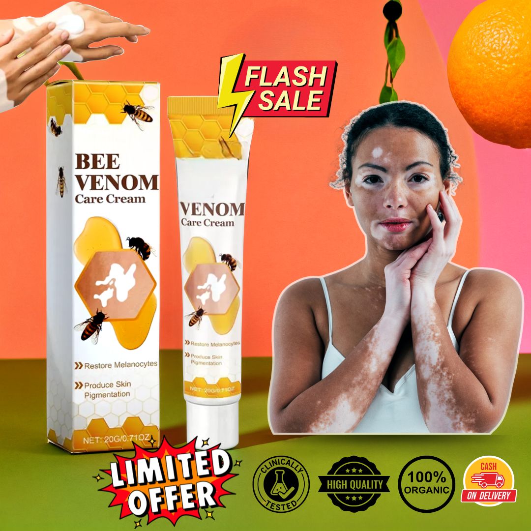 VitiGO Correcting Cream - (✅Buy 1 Get 1 FREE- 30 Days Pack)