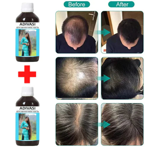 ADIVASI NEELGIRI HERBAL HAIR OIL 125ML 🔥Buy 1 Get 1 FREE🔥
