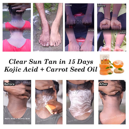 Kojic Skin Whitening Soap – Glow Up, Tan Out! 🚿🌞 (Buy 1 Get 1 FREE 🔥)