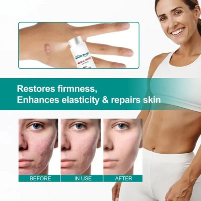 QB Scar Removal Spray - Say Goodbye to Scars Forever 🌟🌿