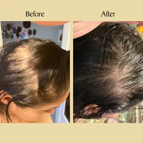 Rabbit Hair Growth Oil - Buy 1 Get 1 FREE