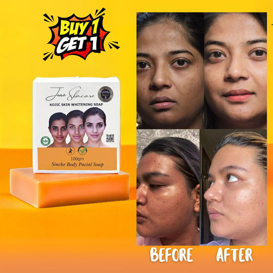 Kojic Skin Lightening Detan Soap - Buy 1 Get 1 FREE🔥🔥