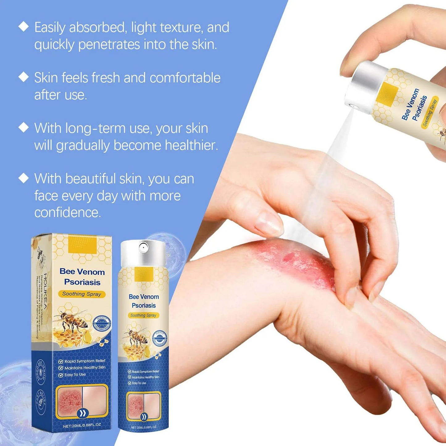 BeeVenom Psoriasis Treatment Spray