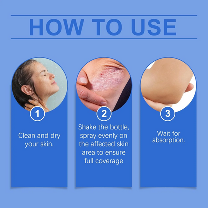 BeeVenom Psoriasis Treatment Spray
