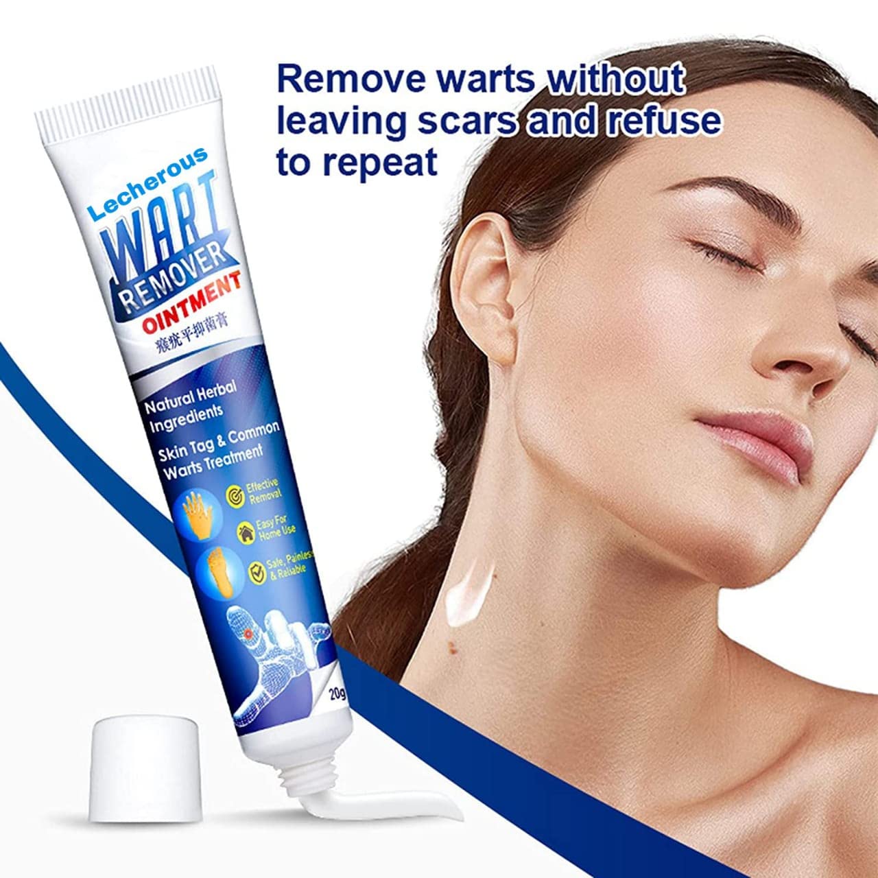 Instant Warts Remover Cream - 🔥Doctor's No 1 Choice🔥