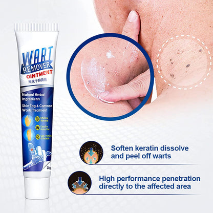 Instant Warts Remover Cream - 🔥Doctor's No 1 Choice🔥